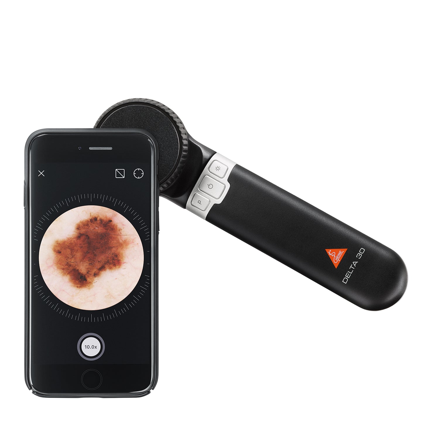 DELTA 30 dermoscope HEINE