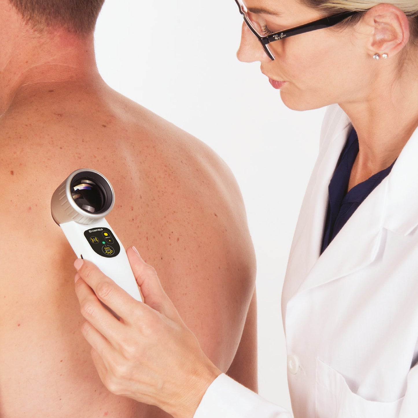 Dermoscope LUMINIS 2